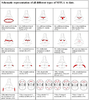 Red-compact-lines-line-of-incision-Each-type-of-VYLA-surgery-includes-two-images-which.png
