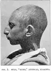 brachycephalic-armenoid-type.webp