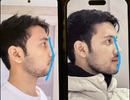 1000024664.png