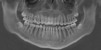 xray 2 (1).png