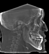 xray 1 (1).png