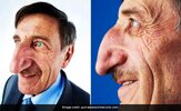 fa5donk_man-with-longest-nose-guinness-1200_625x300_24_May_23.jpg