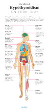 Hypothyroidism_Effects_Pinterest_v2.jpg