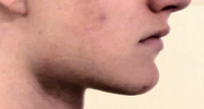 1000017963.png