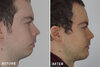 Male-Chin-1-Back-1.jpg