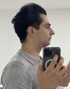 pre-op profile.JPEG pre-op profile.JPEG