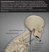 forward-head-posture-tension-WEB.png