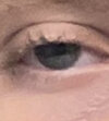 bad eye.jpg