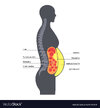 visceral-fat-diagram-vector-47378870.jpg