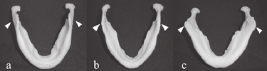 2585542_Inverted-mandibles-show-three-types-of-the-gonial-angle-indicated-by-arrowheads-a-and.png