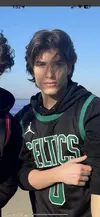 is-this-kind-of-glow-up-possible-without-surgeries-v0-zvfr6qweef2b1.webp
