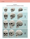 age-related-morphological-changes-of-skull.jpg