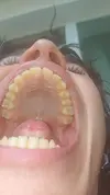 dd5e4555ac67ac6ec07c5c1ebf27e853_0.webp