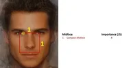 midface.webp