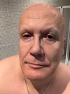 bald-and-browless-long-time-but-beard-or-not-v0-xjbpwihemjud1.webp