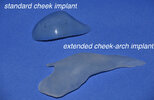 Standard-vs-Extended-Cheek-Arch-Implant-Style-Dr-Barry-Eppley-Indianapolis-1.jpg