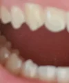 20260724_114622.webp