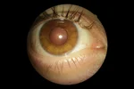 Eye 2 (2).webp