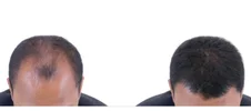1000007294.webp
