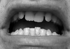 Teeth.webp