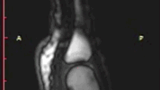 3045183-poster-p-1-mrijoint.gif