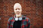 bilder med Black Albino Person ... bilder med Black Albino Person ...