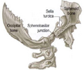 sphenobasilar-junction-Google-Search.png