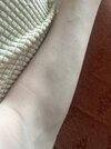 MySkin.jpeg
