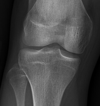 6665042 knee 1