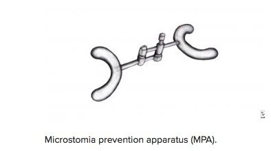 Facial Flex - Adult Microstomia Prevention Appliance-CR4050