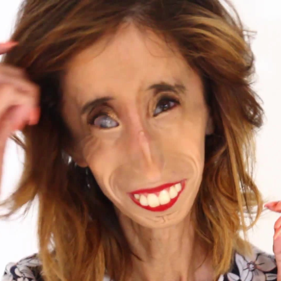 The Ugliest Woman in the World Shares What Makes Her Feel Beautiful  (VIDEO) | Allure