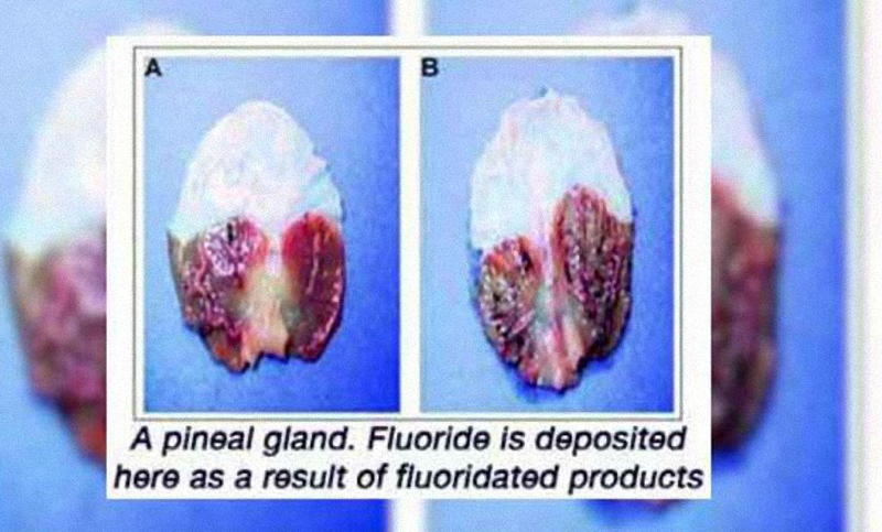 glandula-pineal.jpg