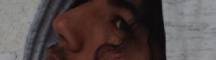 Nasal brideg
