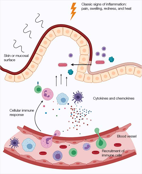 Inflammation | Bio-Rad