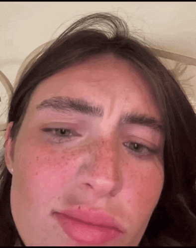 a close up of a woman 's face with freckles making a face