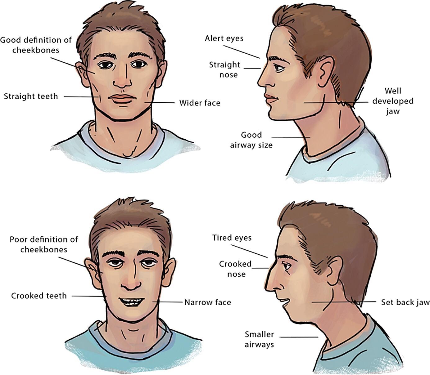 Chad nasal breather vs virgin mouth breather : virginvschad