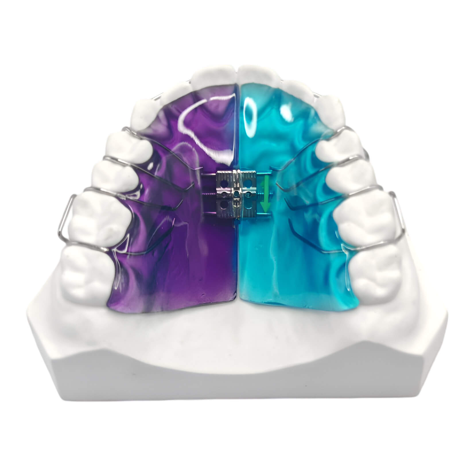 www.bracesshop.net