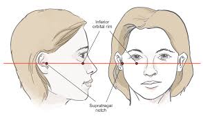 Frankfort Horizontal Plane