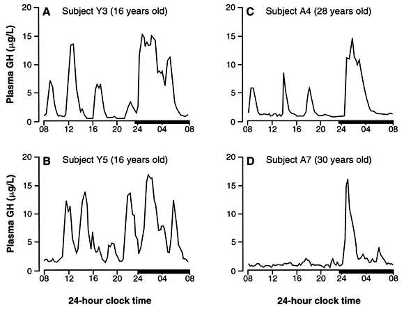 Physiology of growth hormone secretion during sleep ...