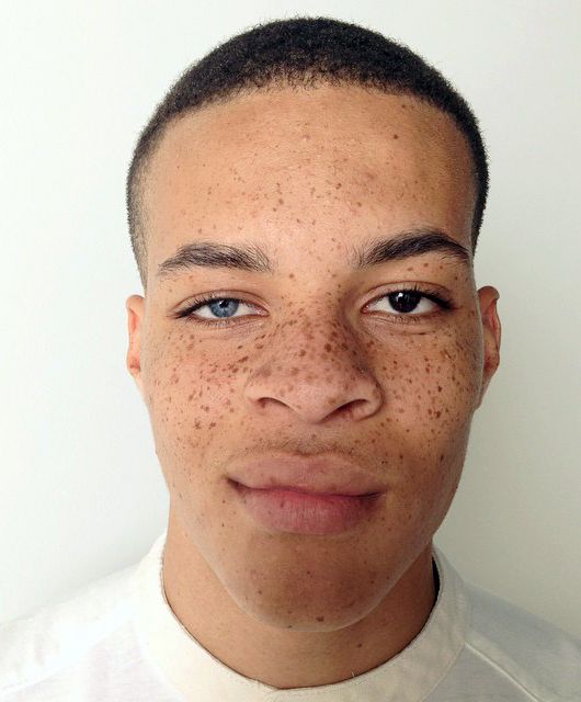 Heterocromia | Drawing people, Perspective photography, Interesting faces