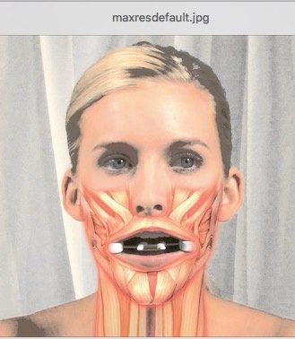 Facial Flex - Adult Microstomia Prevention Appliance-CR4050