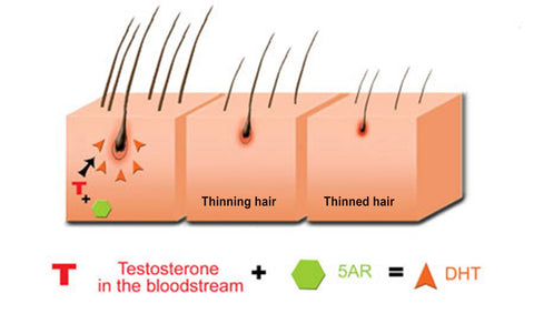 hairloss-dht_480x480.jpg