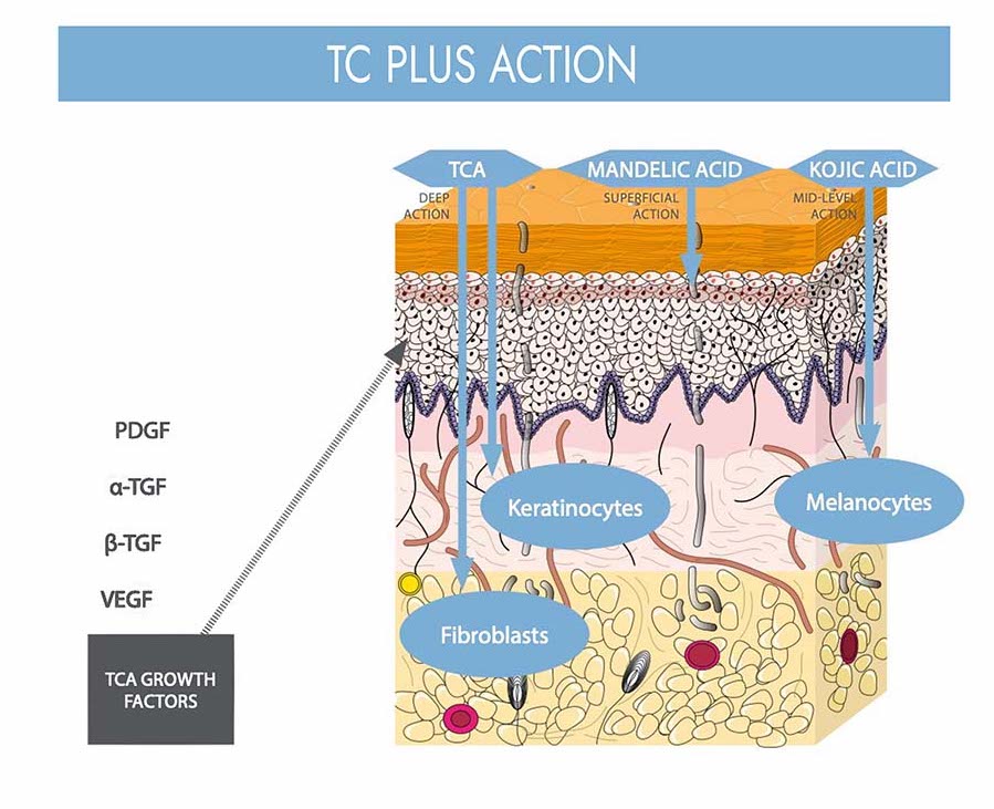 TC Plus Peel In South Africa – An Innovative Dermo-Epidermal Bio-revitaliser From KSurgery ...