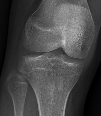 6665043 knee 2