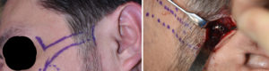 exploreplasticsurgery.com