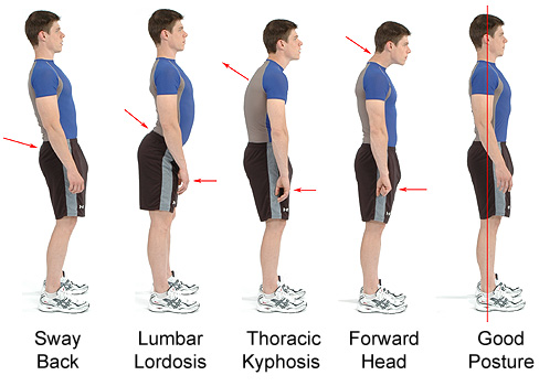 How to Improve Posture? Posture Exercises to Correct Bad ...