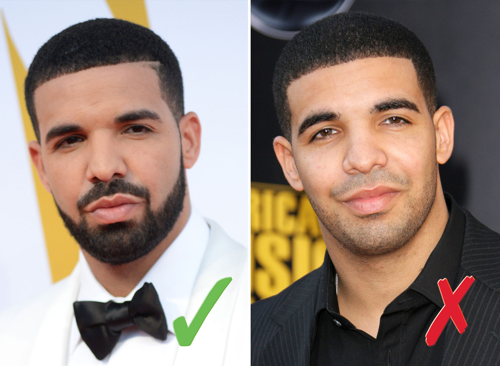Image result for drake before and after beard