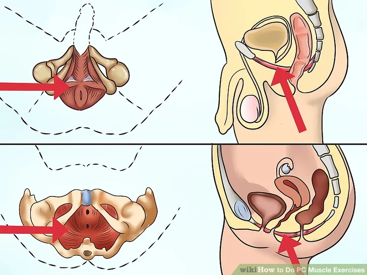 Image titled Do PC Muscle Exercises Step 1 Image titled Do PC Muscle Exercises Step 1