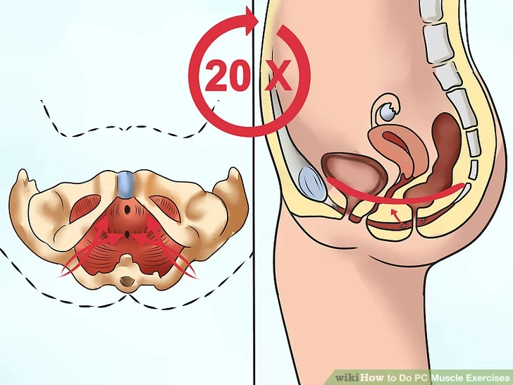 Image titled Do PC Muscle Exercises Step 2 Image titled Do PC Muscle Exercises Step 2